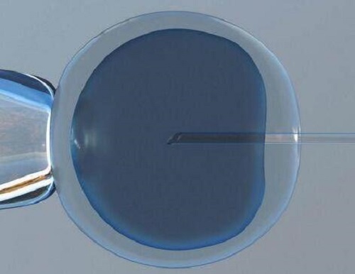 试管婴儿要多少钱