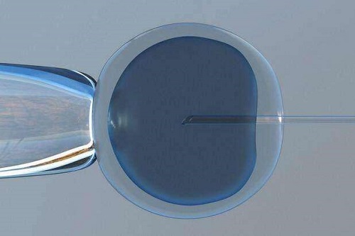 重度宫腔粘连分离术后试管的成功率多少?