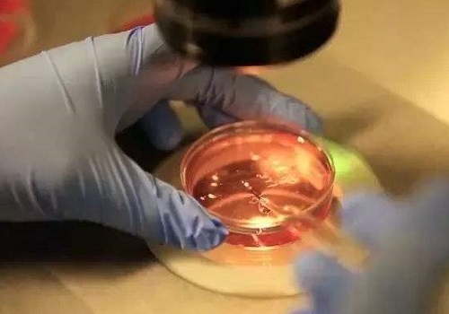 试管婴儿要多少钱？